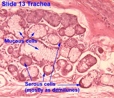 Trachea Histology Labeled Seromucous Glands